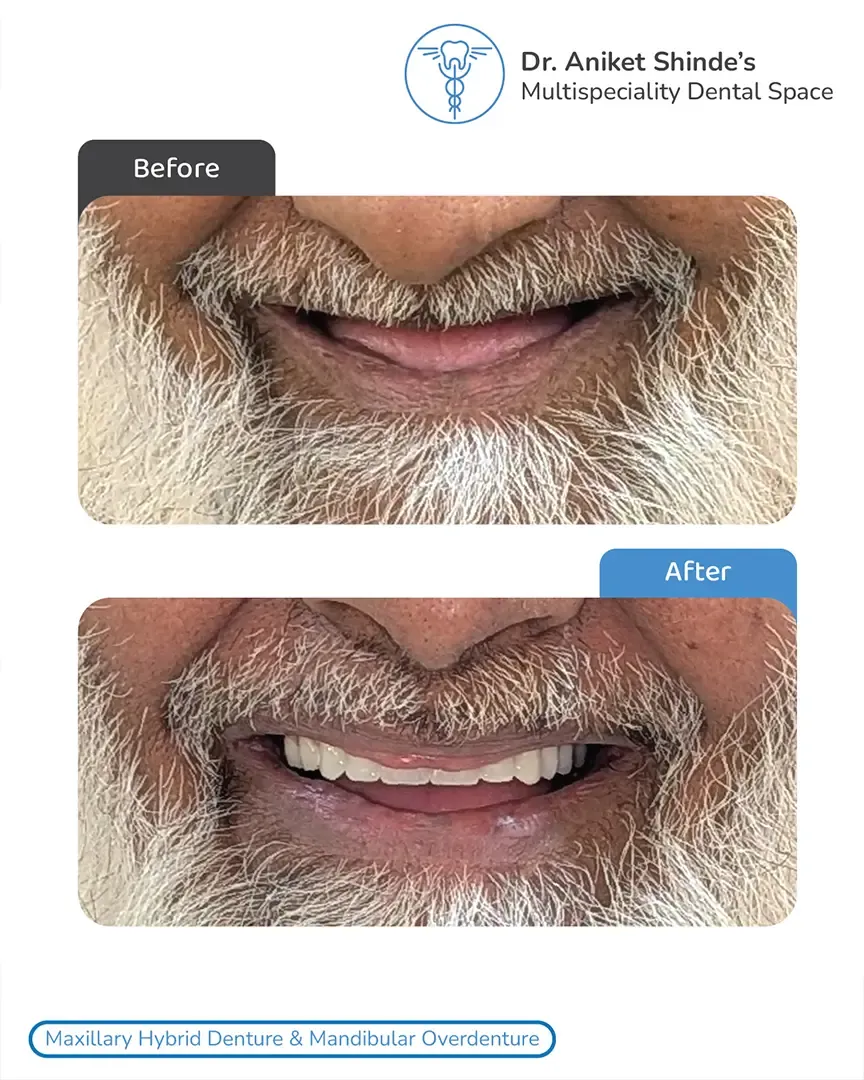 Dr. Aniket Shinde's Dental Clinic