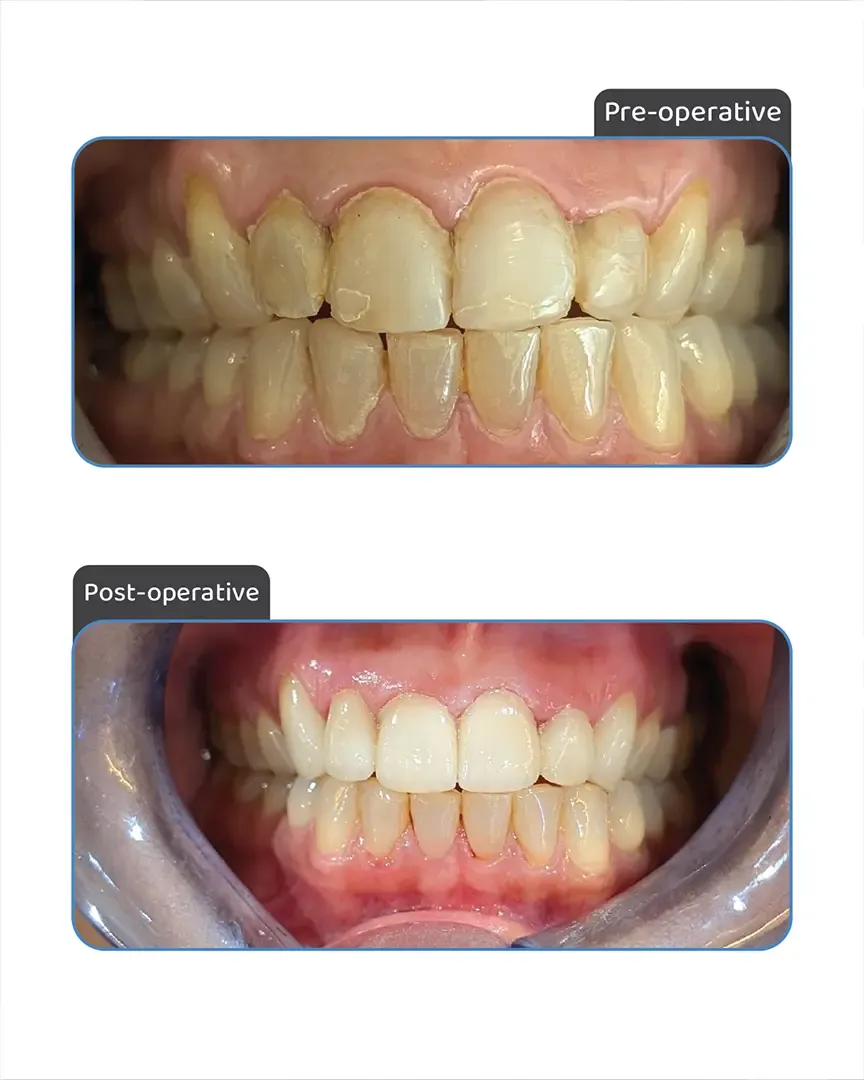 Dr. Aniket Shinde's Dental Clinic